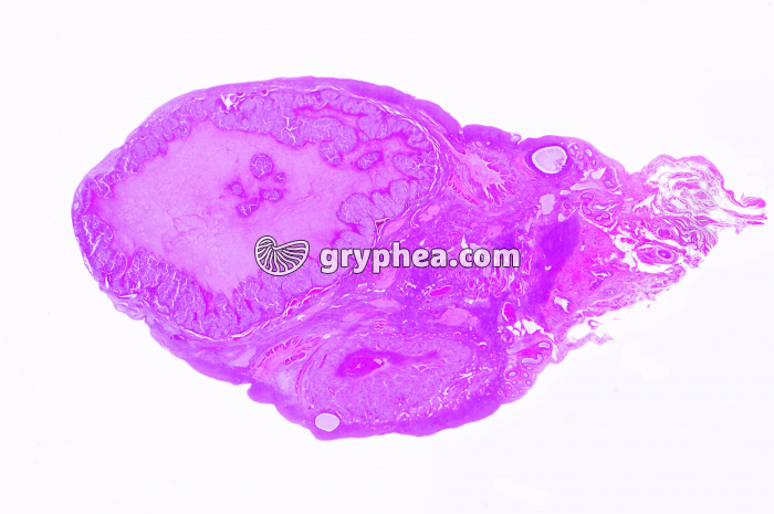 Ovaire humain avec corps jaune entier x2 - gryphea.com